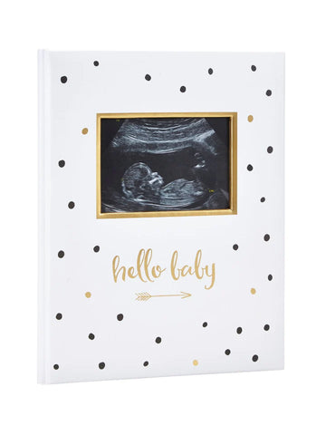 Baby Book - Sonogram