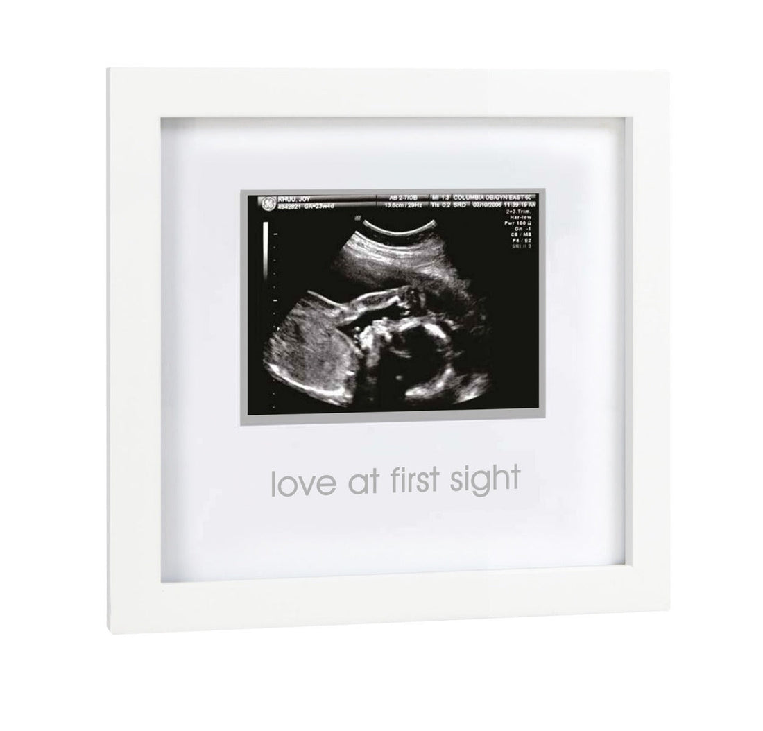 Love at First Sight Sonogram Frame