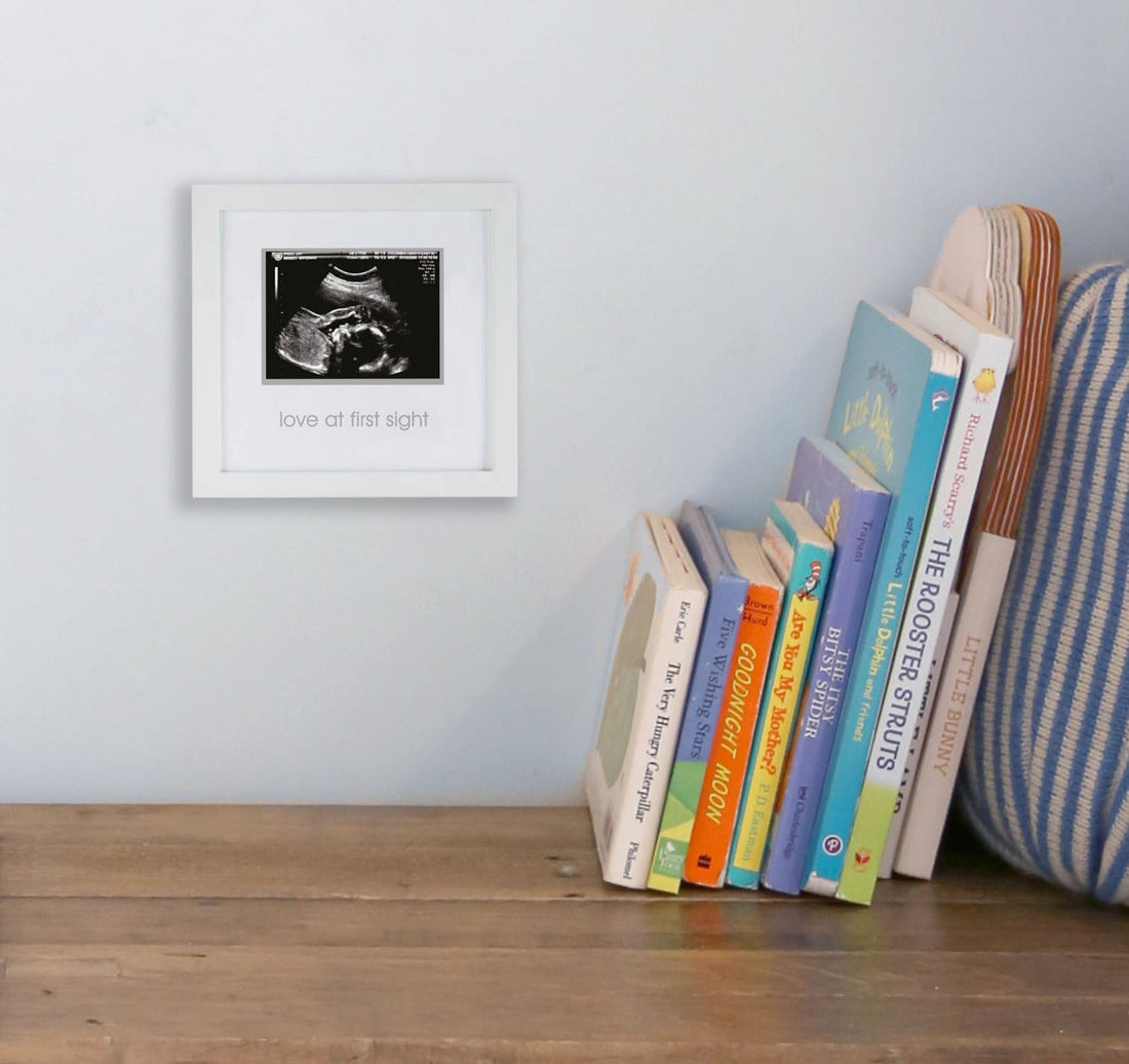 Love at First Sight Sonogram Frame