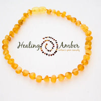 Healing Amber Bracelet/Anklet 5.5-9" Length